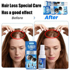 Sumifun Hair Growth Cream – Anti Hair Loss & Regrowth Cream for Men & Women zambeel