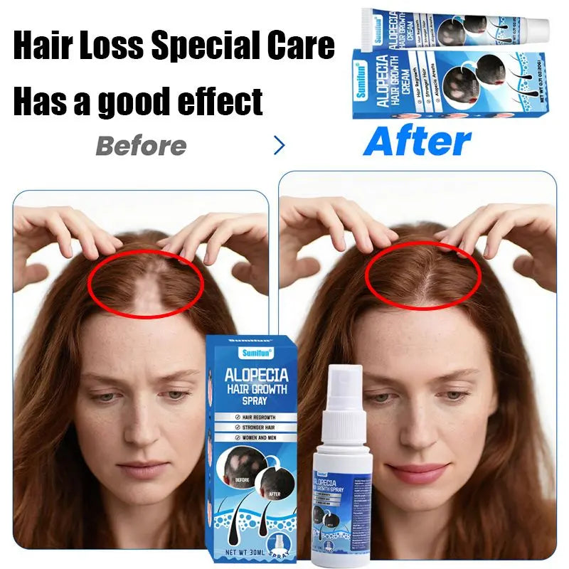Sumifun Hair Growth Cream – Anti Hair Loss & Regrowth Cream for Men & Women zambeel