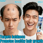 Sumifun Hair Growth Cream – Anti Hair Loss & Regrowth Cream for Men & Women zambeel