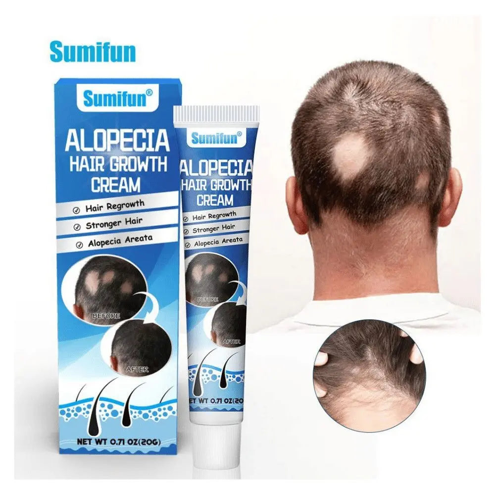Sumifun Hair Growth Cream – Anti Hair Loss & Regrowth Cream for Men & Women zambeel