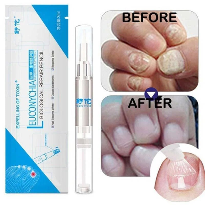 Sumifun - Nail Fungus Treatment Liquid (Original) zambeel