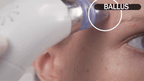 Pore Cleaning Device glimrostore