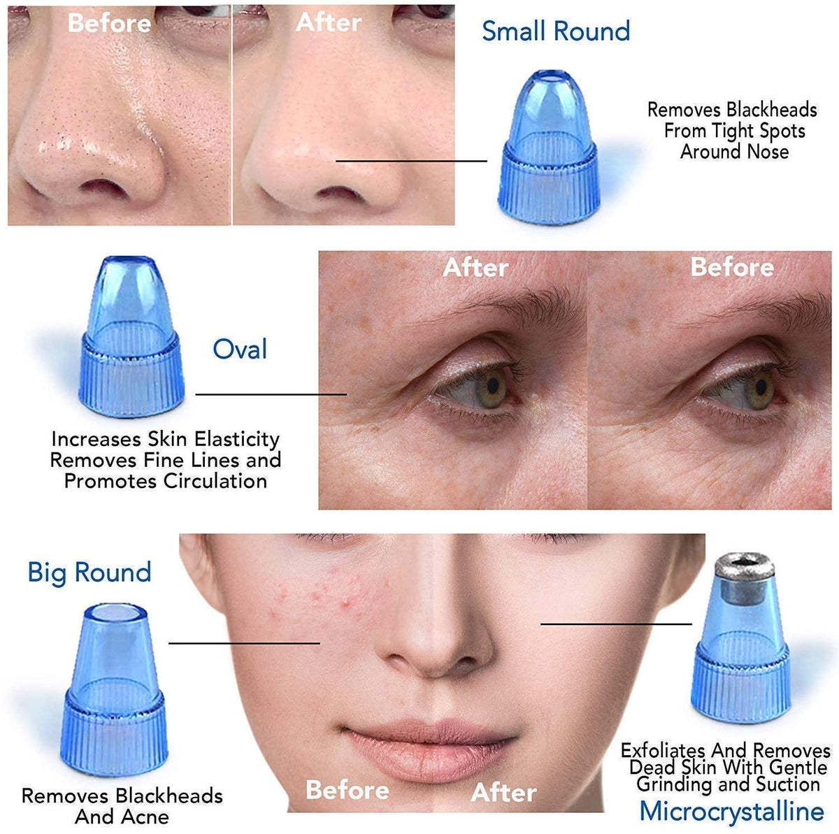 Pore Cleaning Device glimrostore