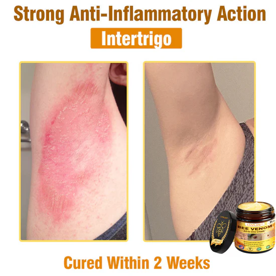 South Moon Bee Venom Pain Relief Cream for Arthritis, Muscle & Joint Discomfort (Original) zambeel