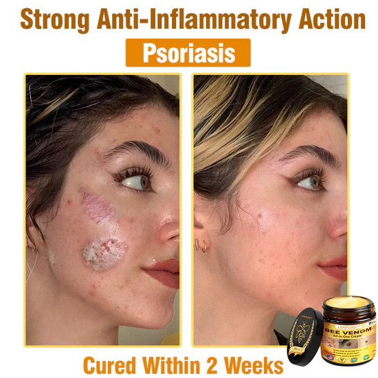 South Moon Bee Venom Pain Relief Cream for Arthritis, Muscle & Joint Discomfort (Original) zambeel