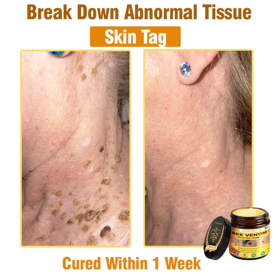 South Moon Bee Venom Pain Relief Cream for Arthritis, Muscle & Joint Discomfort (Original) zambeel