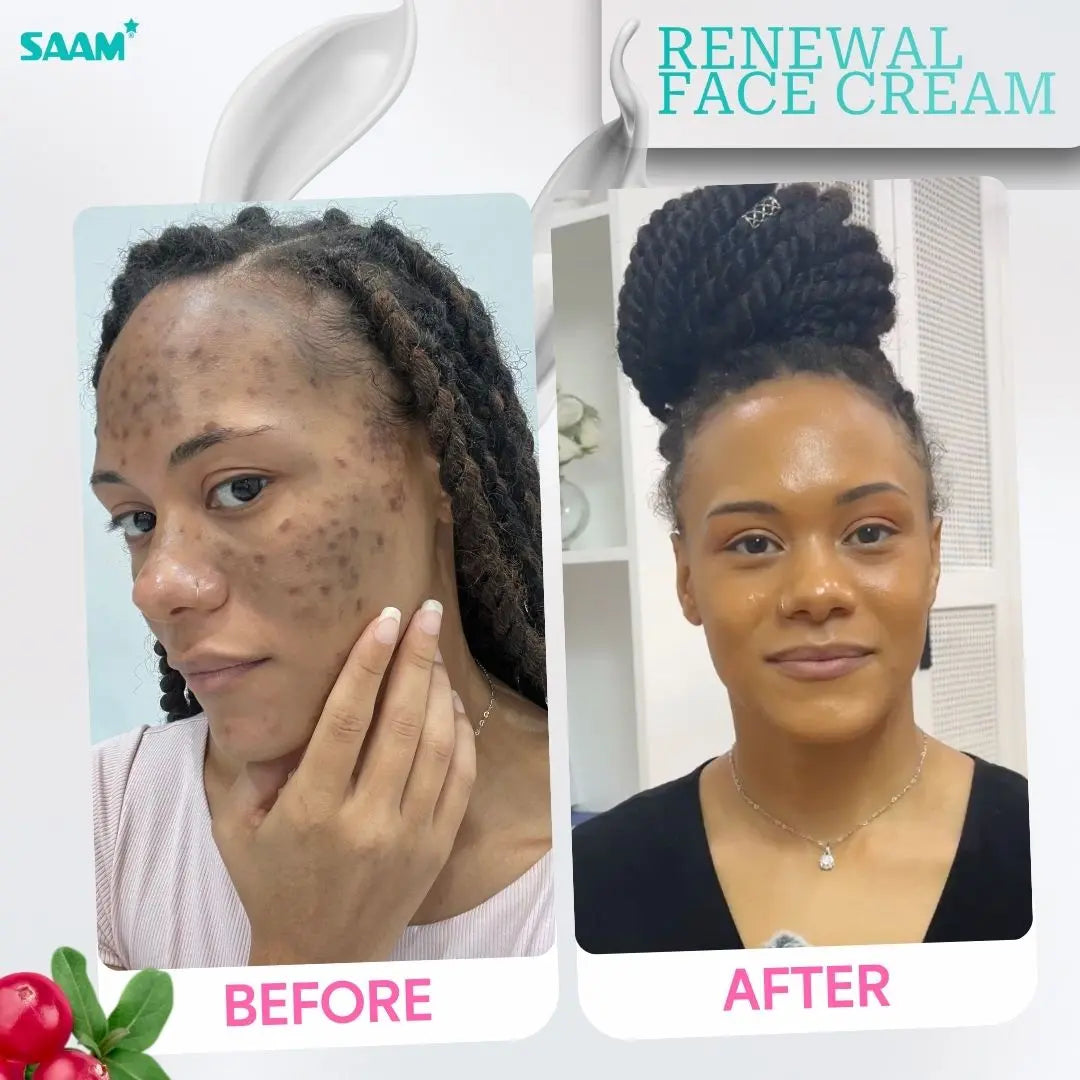 SAAM Renewal Face Cream Original | Daily Moisturizing & Skin Repair Cream zambeel