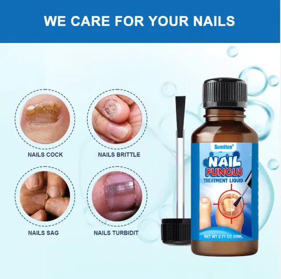 Sumifun - Nail Fungus Treatment Liquid (Original) zambeel