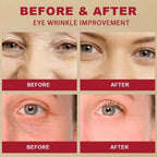 Seoul 1988 Eye Cream zambeel
