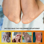 Sumifun - Gout Relief Cream (Original) zambeel