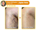 South Moon Bee Venom Pain Relief Cream for Arthritis, Muscle & Joint Discomfort (Original) zambeel