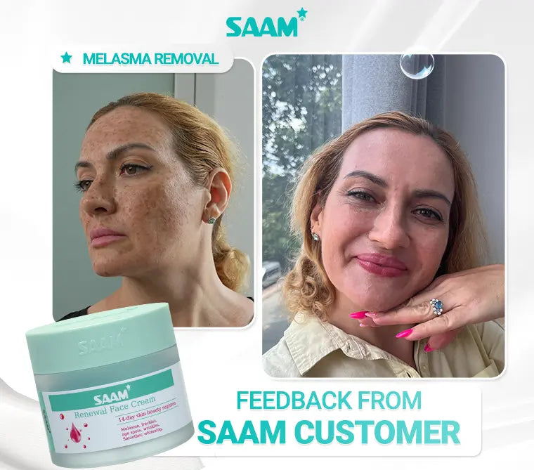 SAAM Renewal Face Cream Original | Daily Moisturizing & Skin Repair Cream zambeel
